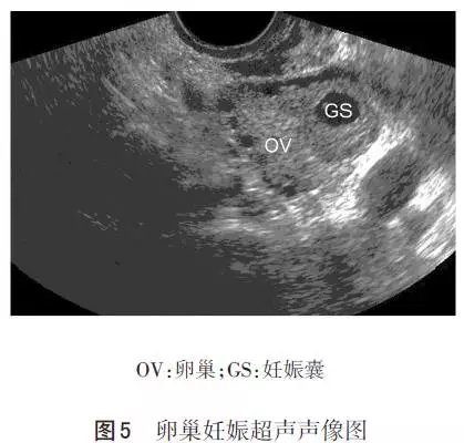 最新型流產(chǎn)技術(shù)，改變未來的希望之光，最新型流產(chǎn)技術(shù)，點(diǎn)亮未來之光