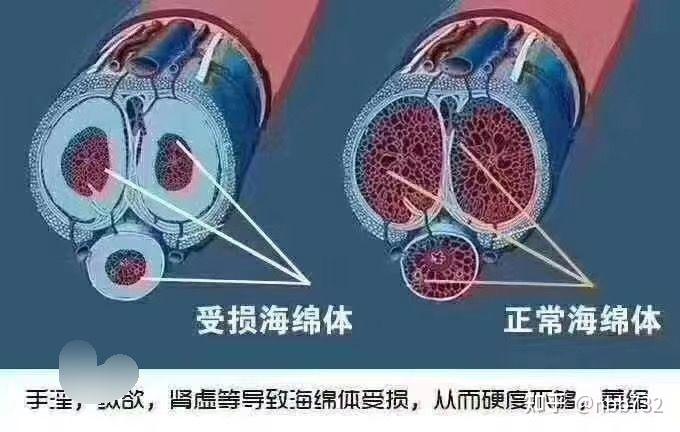 海綿體修復(fù)膏的效果與實(shí)際應(yīng)用探討，海綿體修復(fù)膏效果及實(shí)際應(yīng)用探討