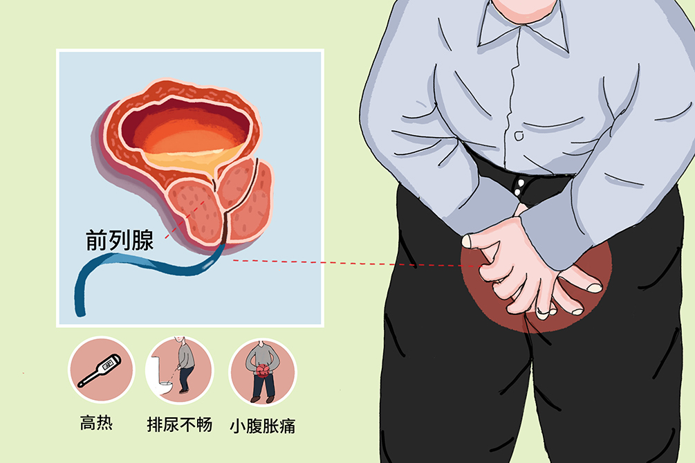 前列腺保健的一般做法，了解、預防與保護，前列腺保健指南，了解、預防與保護措施